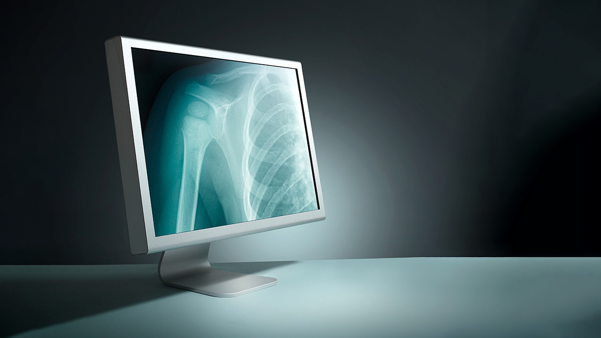 Qué significarán las «tiendas de aplicaciones» de IA para la radiología